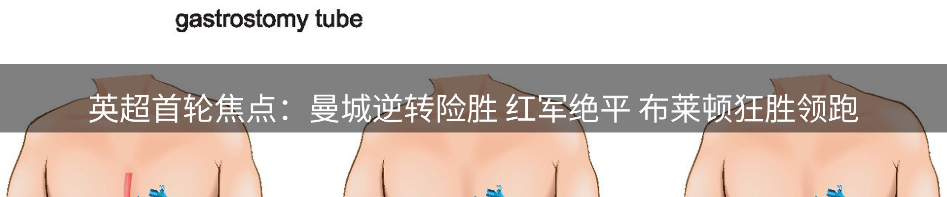 赛事资讯